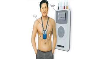 Holter Monitor